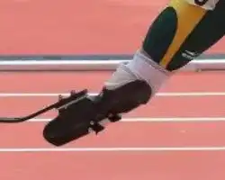 WHAT DOES IT MEAN TO DREAM OF AN AMPUTATED LIMB WHAT DOES IT MEAN TO DREAM OF AN AMPUTATED LIMB